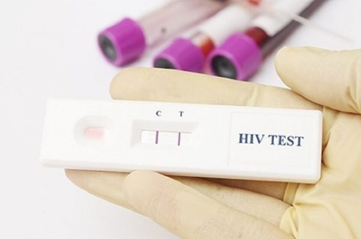 Вич в домашних условиях. Экспресс тест на ВИЧ положительный результат. Экспресс тест на ВИЧ HIV. Тест на ВИЧ 1/2. Тест на СПИД экспресс тест.