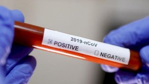 За прошедшие сутки в Казахстане выявлено почти 800 новых случаев заболевания коронавирусом
