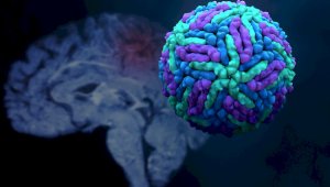 Как COVID-19 воздействует на мозг человека – результаты исследований