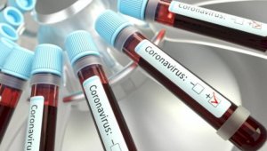 788 новых случаев коронавируса зарегистрировано в Казахстане