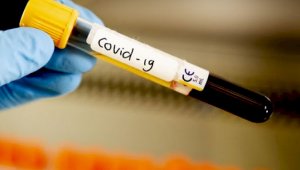 В РК суточный прирост заболевших коронавирусом составил 920 человек