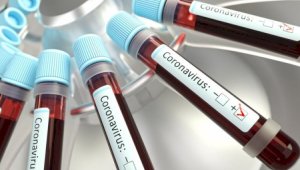 Стали известны новые данные о суточной заболеваемости коронавирусом в РК