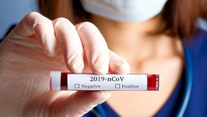 Проверять кровь на антитела против коронавируса нет смысла – Алмаз Шарман