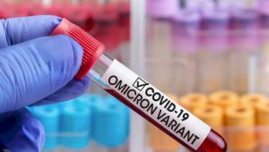 Тест по определению омикрон-штамма коронавируса создали в России