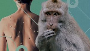 ВОЗ: оспа обезьян выявлена в 24 странах мира