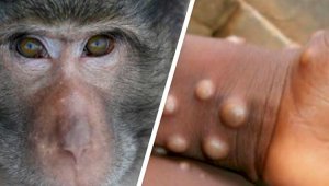Оспа обезьян: в Испании выявили 27 новых случаев заражения человека