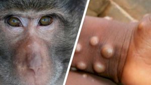 В Казахстане приняли профилактические меры по недопущению завоза оспы обезьян