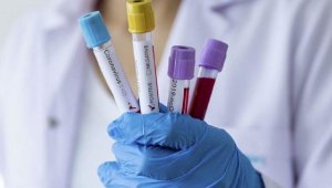 За сутки в Казахстане зарегистрировано 477 новых случаев заражения коронавирусом