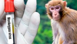 Рекордное число новых случаев заболевания оспой обезьян выявлено в США за сутки