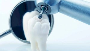 Более 3,9 млрд тенге выделено на стоматологию в Алматы