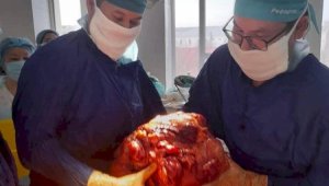 Врачи-онкологи удалили у жителя Атырау опухоль весом 15 килограммов