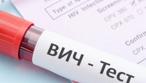 В США создали генную терапию, уничтожающую ВИЧ