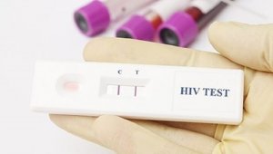 Аким Алматы прокомментировал выявленные случаи ВИЧ в больнице города