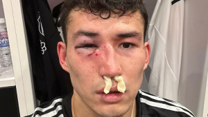 «Бешикташ» опубликовал фото Зайнутдинова после травмы в матче с «Истанбулом»