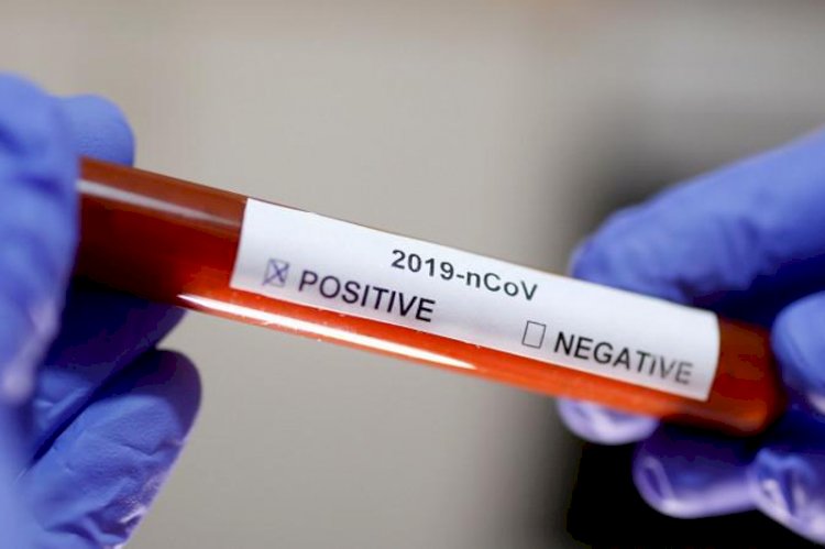 За прошедшие сутки в Казахстане выявлено почти 800 новых случаев заболевания коронавирусом