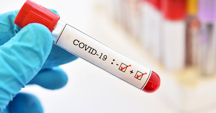 За сутки в РК 2058 человек заразились коронавирусом