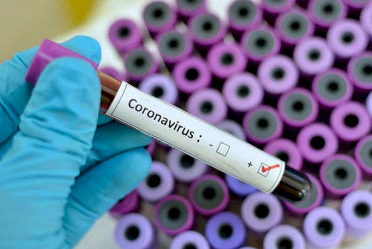 Более 1550 новых случаев заболевания COVID-19 выявлено в Казахстане за сутки