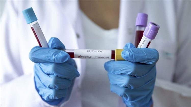 В Казахстане за сутки зафиксирован 5721 случай заболевания коронавирусом