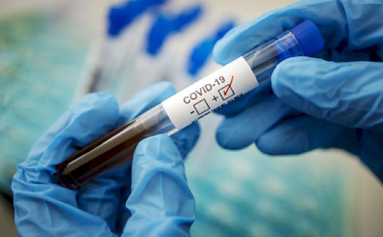 6358 новых случаев коронавируса выявили в Казахстане