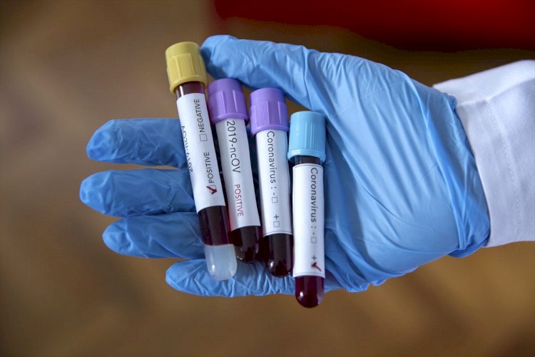 За сутки в Казахстане зарегистрировано около двух тысяч заболевших коронавирусом