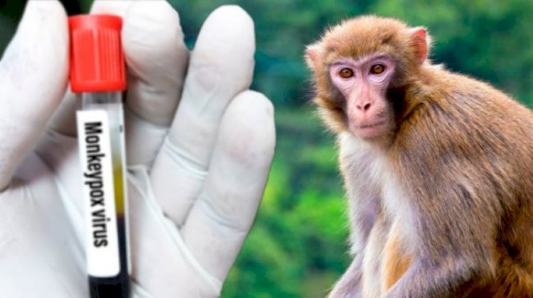 Рекордное число новых случаев заболевания оспой обезьян выявлено в США за сутки