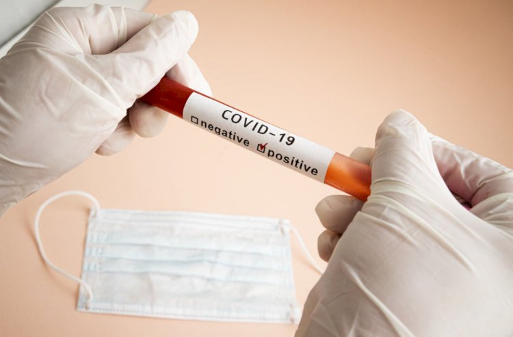 Спад продолжается: за сутки в Казахстане выявлено 100 заболевших коронавирусом