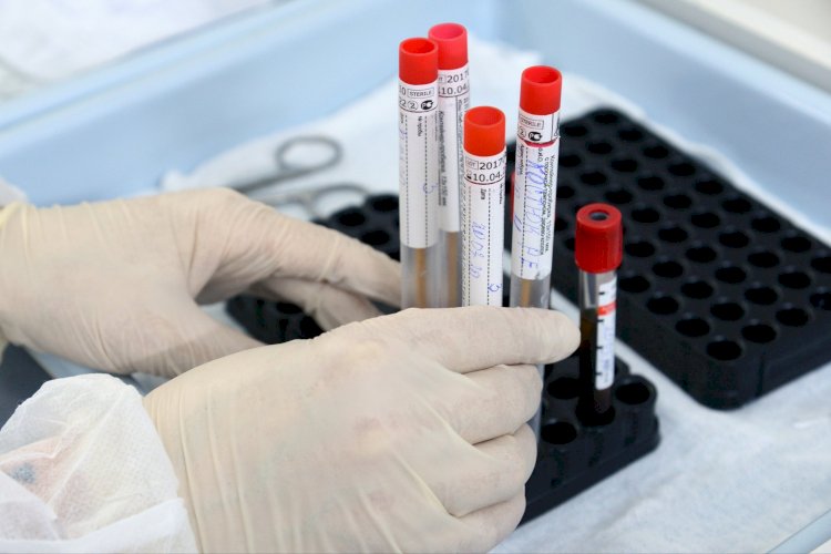 64 новых случая коронавируса за сутки зарегистрировано в РК