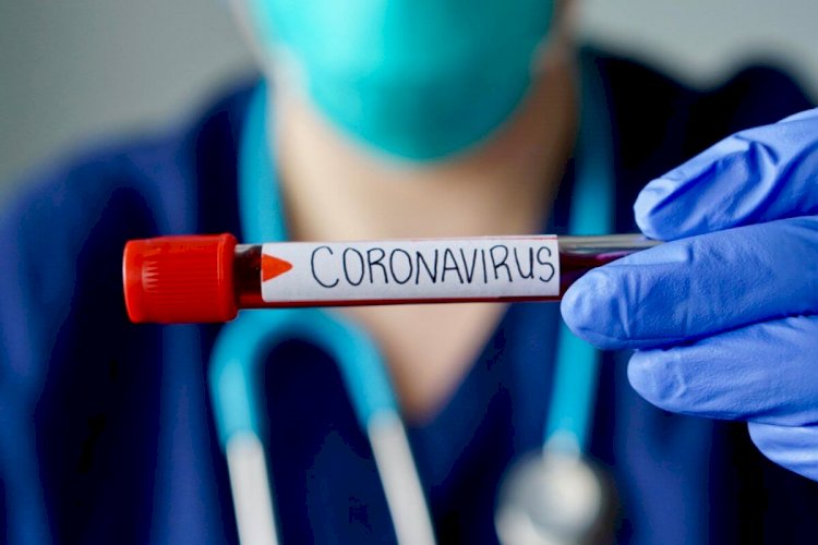 В Казахстане за сутки коронавирусом заболели всего 36 человек