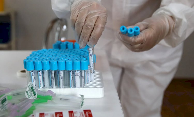 Заболеваемость коронавирусом в Казахстане продолжает идти на спад
