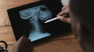  Мошенники уже прикидываются медиками и «приглашают» вас на медосмотр и флюорографию