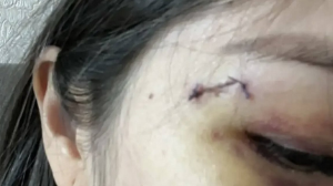 Агрессивная пациентка напала на врачей в Алматы