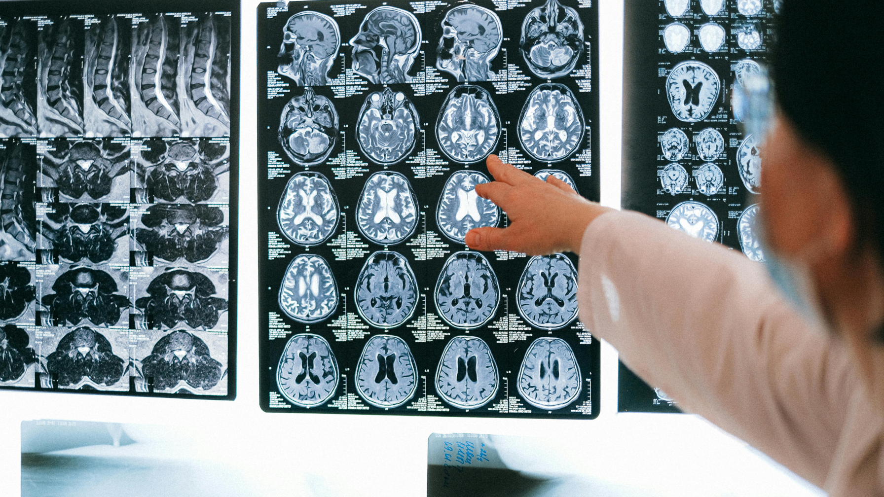 Как в Казахстане выявляют онкозаболевания на ранних стадиях