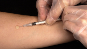 В Казахстане смертность от туберкулеза сократилась на 20%