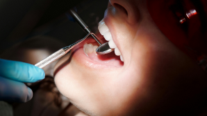 Рак полости рта может начаться с незаметных симптомов – онколог АОЦ