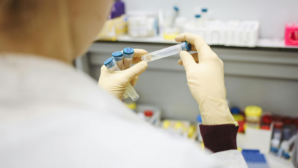 В Астане продолжается рост заболеваемости корью